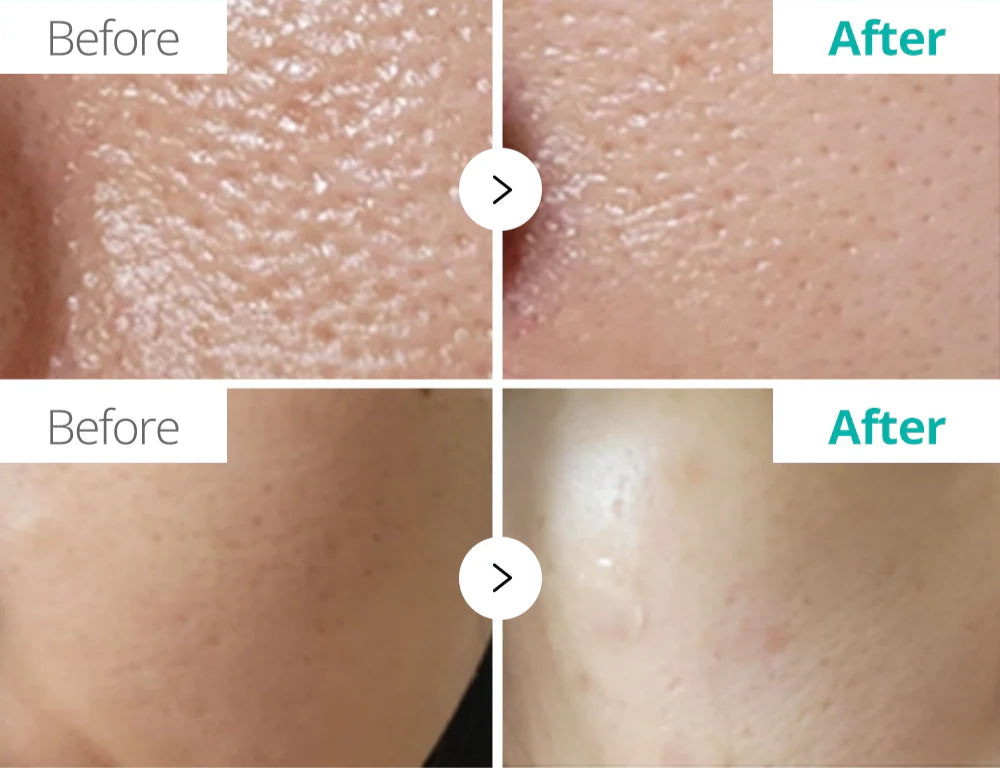 Reveal Your Best Skin and Unleash Confidence